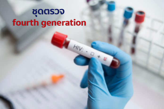 ชุดตรวจ fourth generation การตรวจเอชไอวี