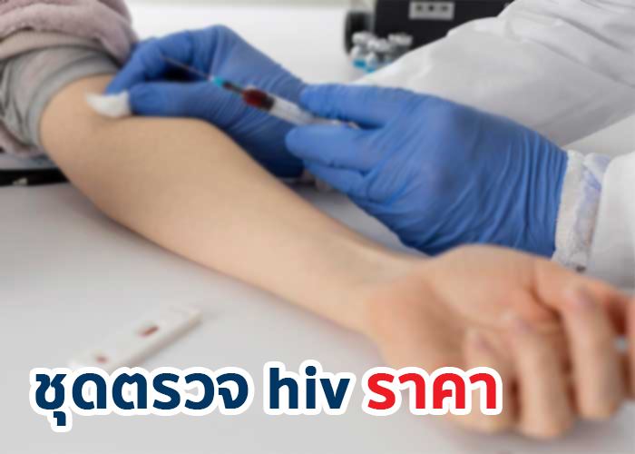 ชุดตรวจ HIV ราคา