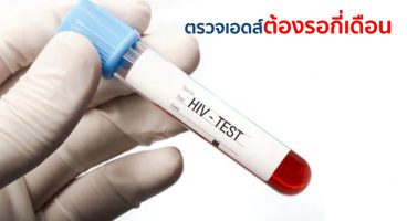 ตรวจเอดส์ต้องรอกี่เดือน ถึงจะชัวร์ว่าติดหรือไม่ติดเชื้อHIV