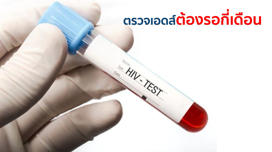 ตรวจเอดส์ต้องรอกี่เดือน ถึงจะชัวร์ว่าติดหรือไม่ติดเชื้อHIV