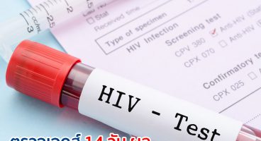 ตรวจเอดส์ 14 วัน ผล ที่ได้จะมีความน่าเชื่อถือหรือไม่